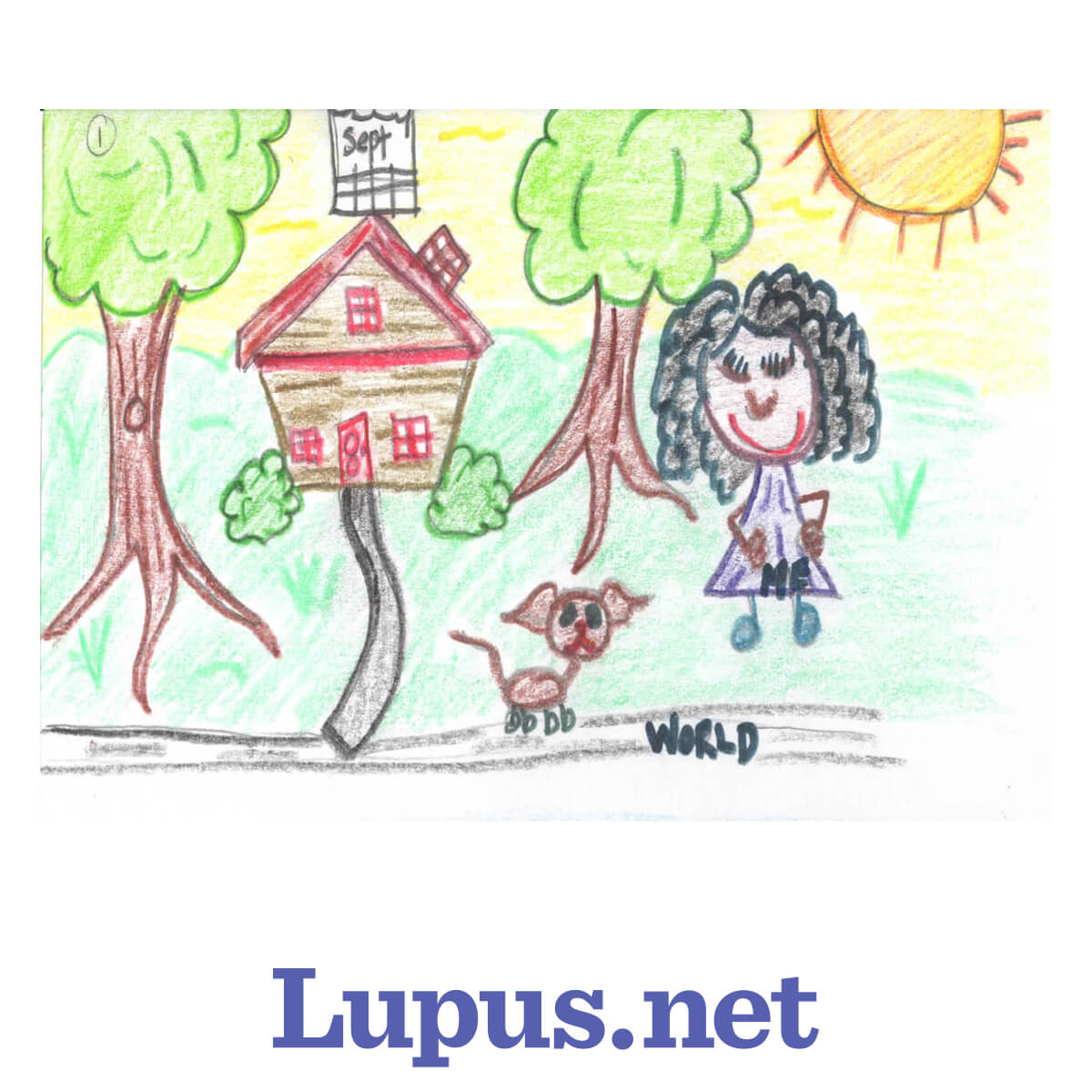 Life With Lupus Through The Seasons Comic, playing outside with her dog in September