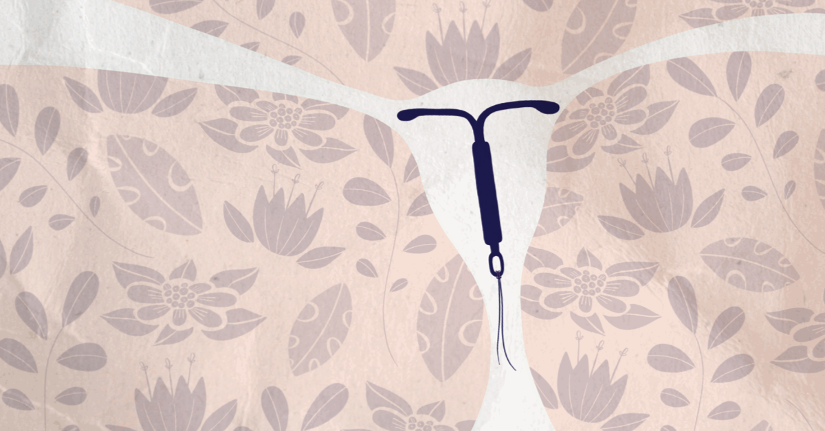 My Experience Being on the IUD Mirena With Lupus