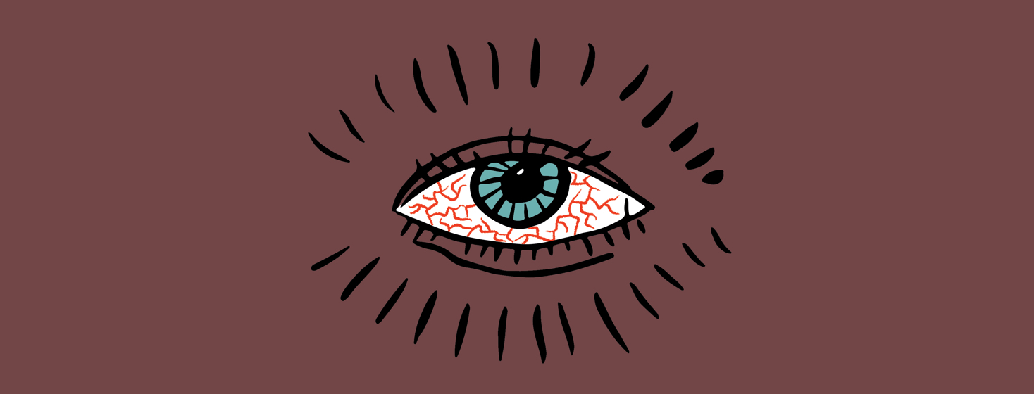 Living with Chronic Dry Eye image