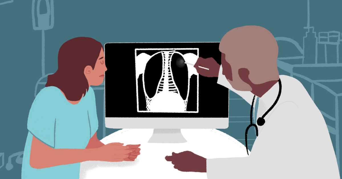 My Latest Pulmonary Issues With Lupus | Lupus.net